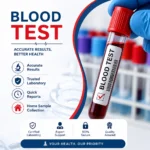 SGOT (AST) Test